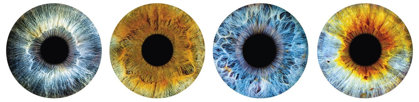 Quattro iridi fotografate con la Iris Camera, ognuna con colori diversi
